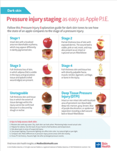Poster shows pressure injury stages using apple and skin cross-section illustrations. This poster is shows injuries on dark skin.